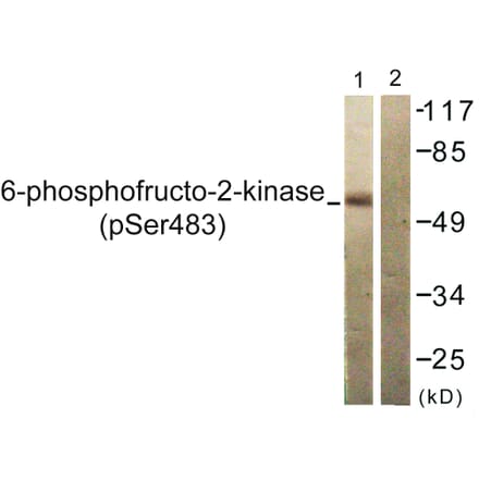 Western Blot - Anti-PFKFB2 (phospho Ser483) Antibody (A0761) - Antibodies.com