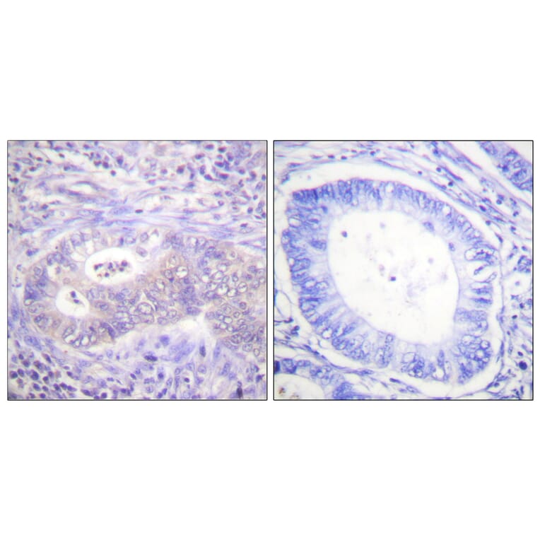 Immunohistochemistry - Anti-PFKFB2 (phospho Ser483) Antibody (A0761) - Antibodies.com