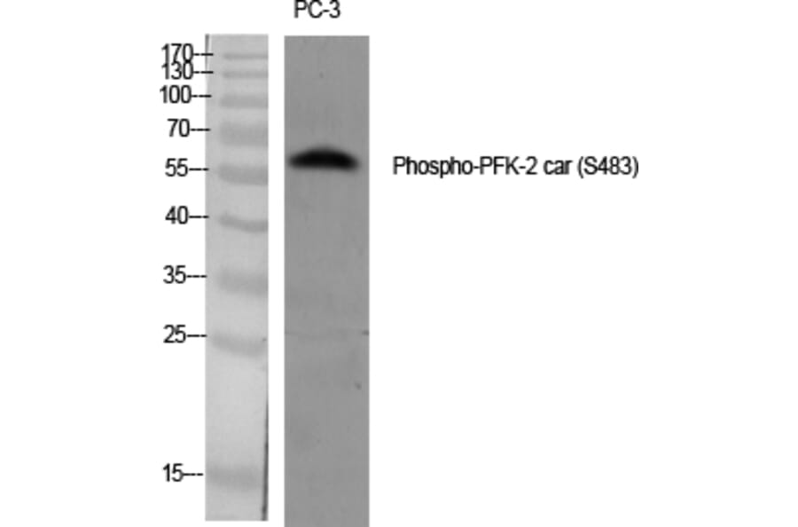 Western Blot - Anti-PFKFB2 (phospho Ser483) Antibody (A0761) - Antibodies.com