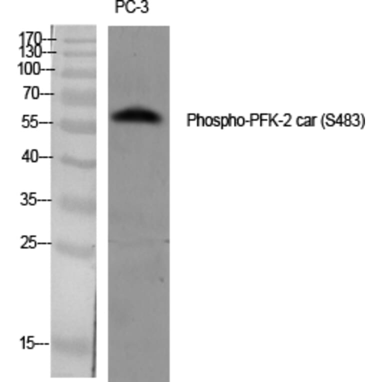 Western Blot - Anti-PFKFB2 (phospho Ser483) Antibody (A0761) - Antibodies.com