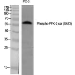 Western Blot - Anti-PFKFB2 (phospho Ser483) Antibody (A0761) - Antibodies.com