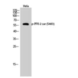 Western Blot - Anti-PFKFB2 (phospho Ser483) Antibody (A0761) - Antibodies.com
