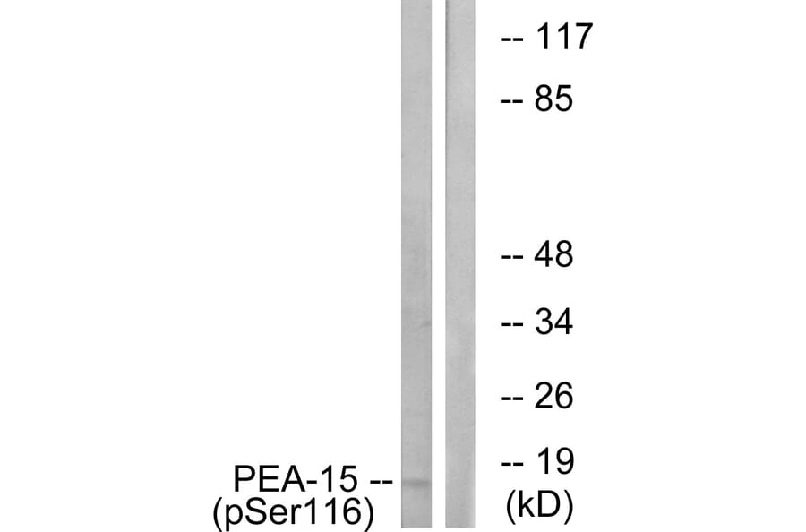 Western Blot - Anti-PEA-15 (phospho Ser116) Antibody (A0545) - Antibodies.com
