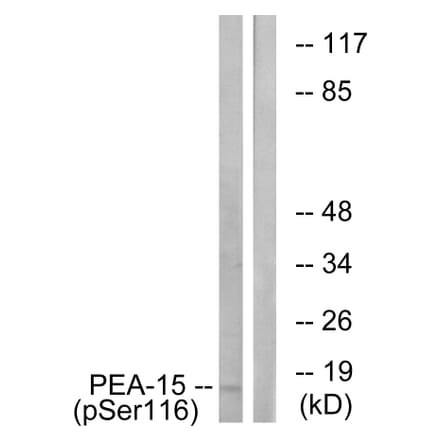 Western Blot - Anti-PEA-15 (phospho Ser116) Antibody (A0545) - Antibodies.com