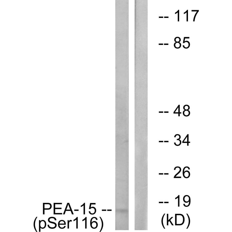 Western Blot - Anti-PEA-15 (phospho Ser116) Antibody (A0545) - Antibodies.com