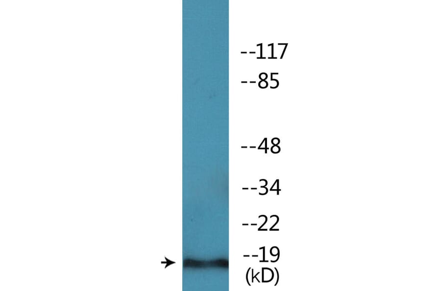 Western Blot - Anti-PEA-15 (phospho Ser104) Antibody (P12-1163) - Antibodies.com