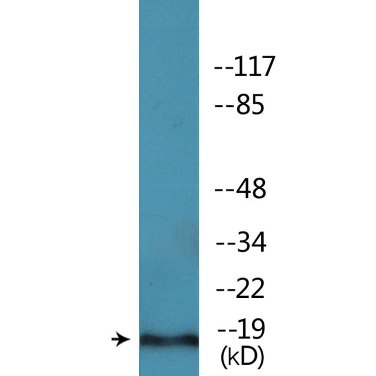 Western Blot - Anti-PEA-15 (phospho Ser104) Antibody (P12-1163) - Antibodies.com