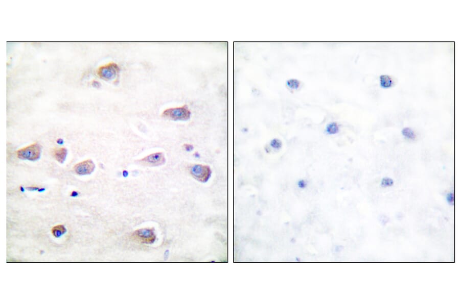 Immunohistochemistry - Anti-NMDAR1 (phospho Ser897) Antibody (A7174) - Antibodies.com
