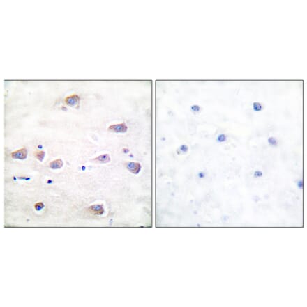 Immunohistochemistry - Anti-NMDAR1 (phospho Ser897) Antibody (A7174) - Antibodies.com