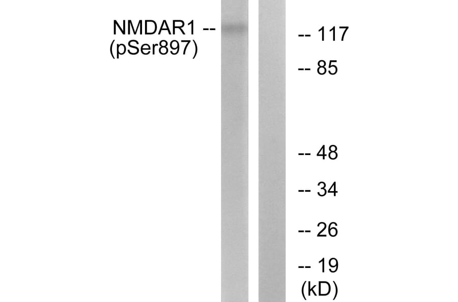 Western Blot - Anti-NMDAR1 (phospho Ser897) Antibody (A7174) - Antibodies.com
