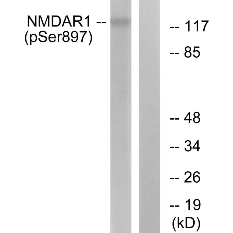 Western Blot - Anti-NMDAR1 (phospho Ser897) Antibody (A7174) - Antibodies.com