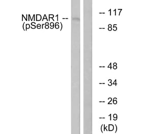 Western Blot - Anti-NMDAR1 (phospho Ser896) Antibody (A0693) - Antibodies.com