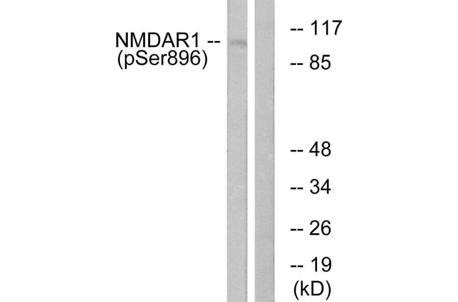 Western Blot - Anti-NMDAR1 (phospho Ser896) Antibody (A0693) - Antibodies.com