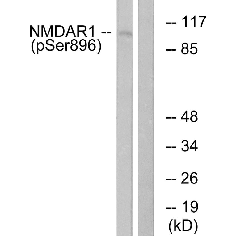 Western Blot - Anti-NMDAR1 (phospho Ser896) Antibody (A0693) - Antibodies.com