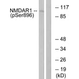Western Blot - Anti-NMDAR1 (phospho Ser896) Antibody (A0693) - Antibodies.com