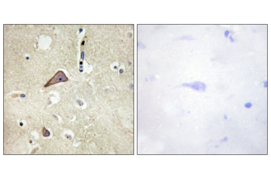 Immunohistochemistry - Anti-NMDAR1 (phospho Ser896) Antibody (A0693) - Antibodies.com