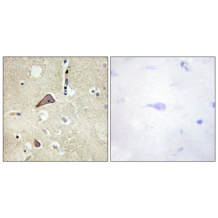 Immunohistochemistry - Anti-NMDAR1 (phospho Ser896) Antibody (A0693) - Antibodies.com
