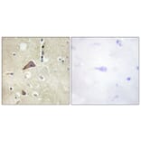Immunohistochemistry - Anti-NMDAR1 (phospho Ser896) Antibody (A0693) - Antibodies.com