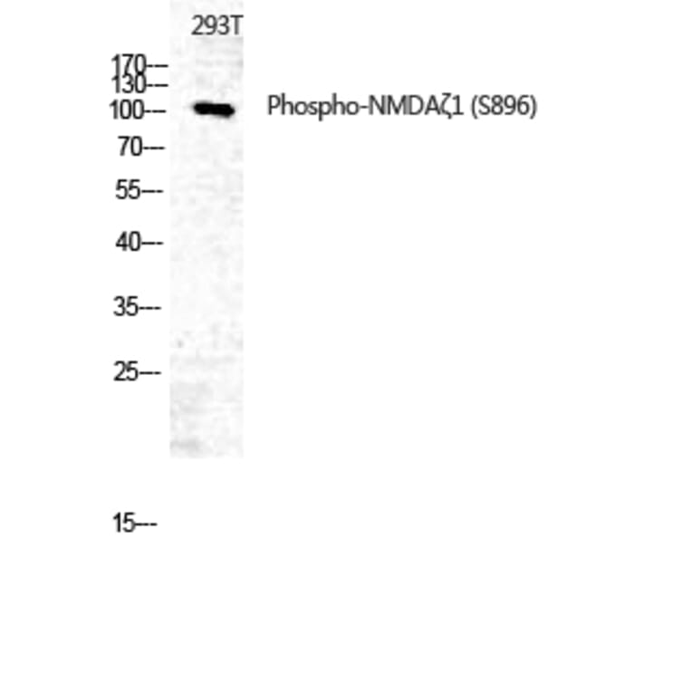 Western Blot - Anti-NMDAR1 (phospho Ser896) Antibody (A0693) - Antibodies.com