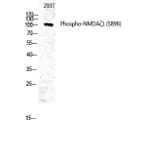 Western Blot - Anti-NMDAR1 (phospho Ser896) Antibody (A0693) - Antibodies.com