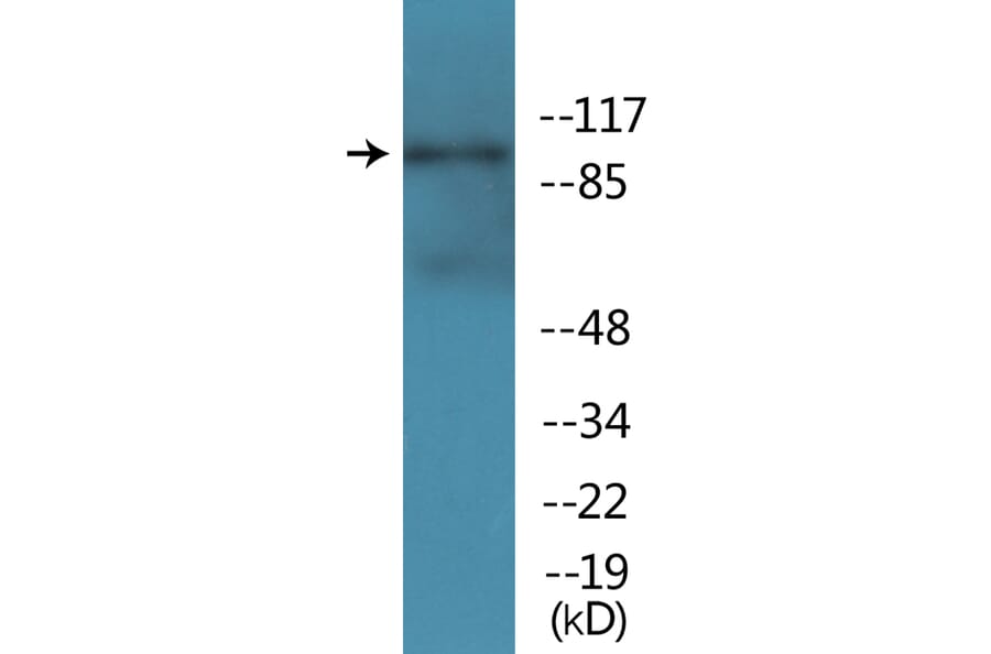 Western Blot - Anti-NMDAR1 (phospho Ser896) Antibody (P12-1154) - Antibodies.com