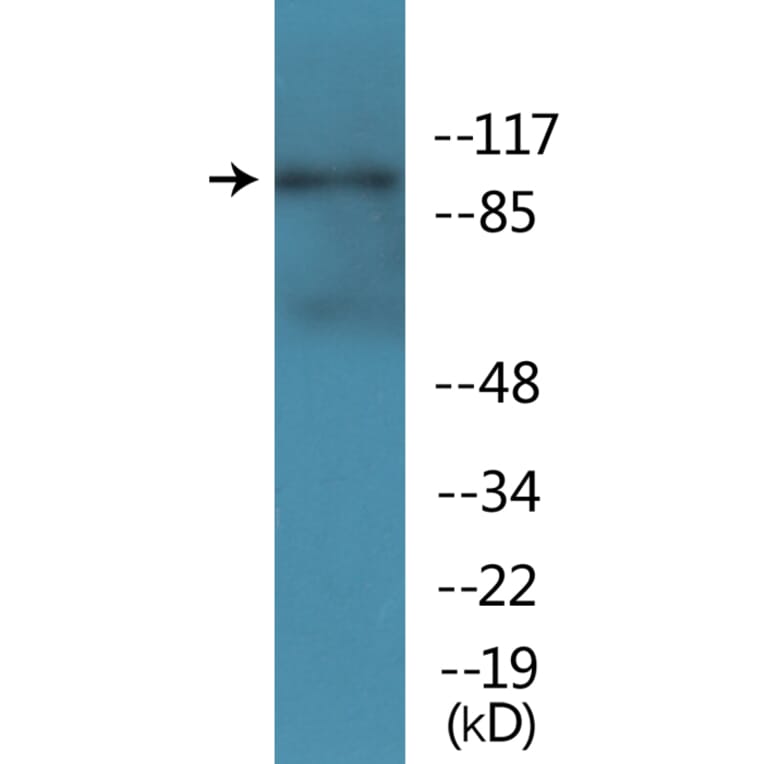 Western Blot - Anti-NMDAR1 (phospho Ser896) Antibody (P12-1154) - Antibodies.com