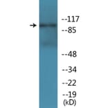 Western Blot - Anti-NMDAR1 (phospho Ser896) Antibody (P12-1154) - Antibodies.com