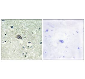 Immunohistochemistry - Anti-NMDAR1 (phospho Ser890) Antibody (A0692) - Antibodies.com