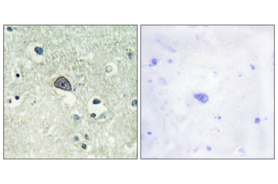 Immunohistochemistry - Anti-NMDAR1 (phospho Ser890) Antibody (A0692) - Antibodies.com