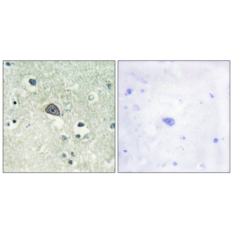 Immunohistochemistry - Anti-NMDAR1 (phospho Ser890) Antibody (A0692) - Antibodies.com