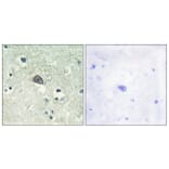 Immunohistochemistry - Anti-NMDAR1 (phospho Ser890) Antibody (A0692) - Antibodies.com