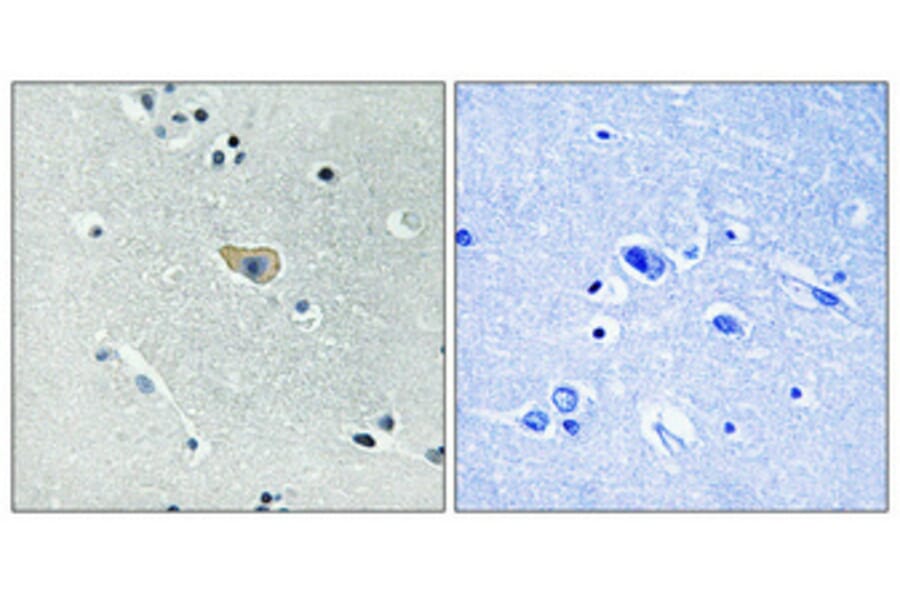 Immunohistochemistry - Anti-NMDAR1 (phospho Ser890) Antibody (A0692) - Antibodies.com