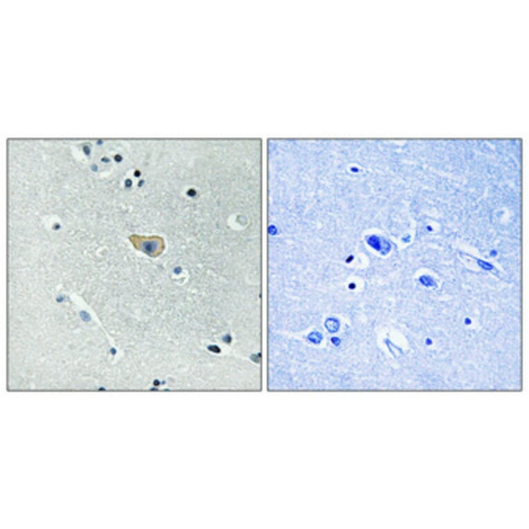 Immunohistochemistry - Anti-NMDAR1 (phospho Ser890) Antibody (A0692) - Antibodies.com