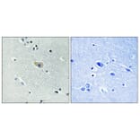 Immunohistochemistry - Anti-NMDAR1 (phospho Ser890) Antibody (A0692) - Antibodies.com
