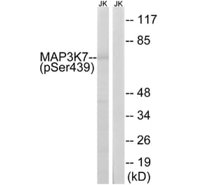 Western Blot - Anti-MAP3K7 (phospho Ser439) Antibody (A8133) - Antibodies.com