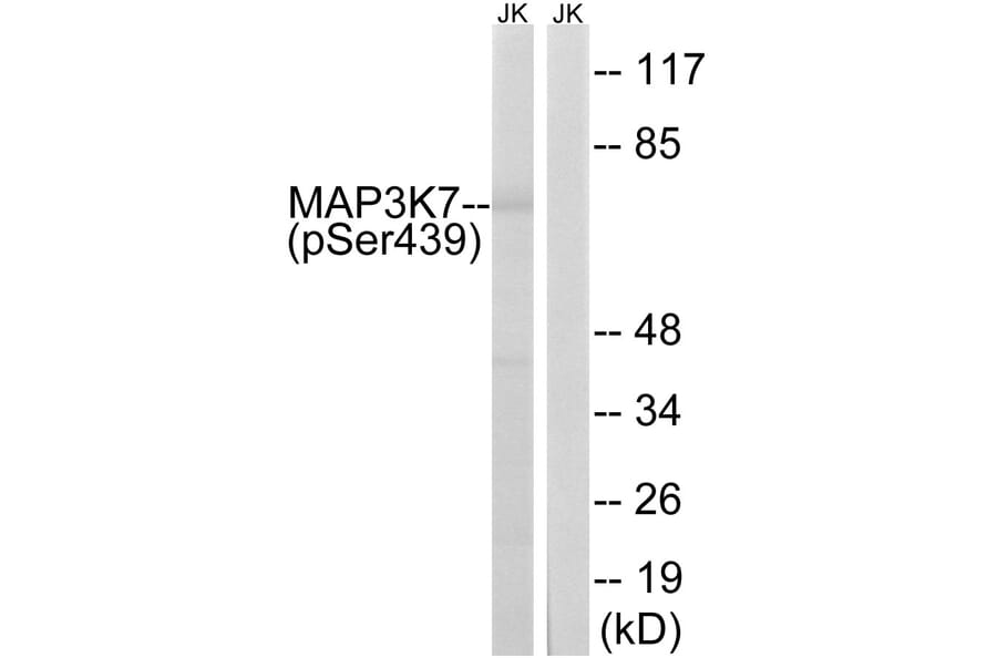 Western Blot - Anti-MAP3K7 (phospho Ser439) Antibody (A8133) - Antibodies.com