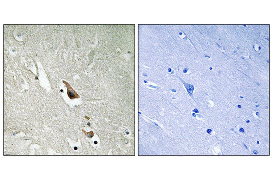 Immunohistochemistry - Anti-MAP3K7 (phospho Ser439) Antibody (A8133) - Antibodies.com