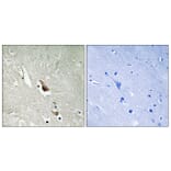 Immunohistochemistry - Anti-MAP3K7 (phospho Ser439) Antibody (A8133) - Antibodies.com