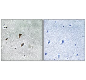 Immunohistochemistry - Anti-MAP2K3 (phospho Thr222) Antibody (A8139) - Antibodies.com