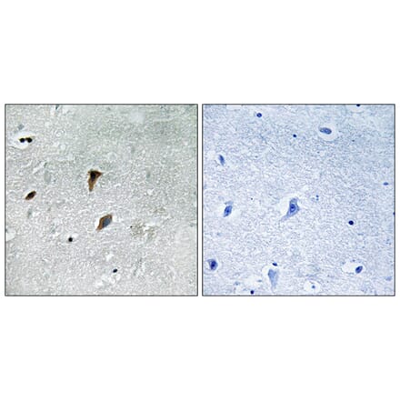 Immunohistochemistry - Anti-MAP2K3 (phospho Thr222) Antibody (A8139) - Antibodies.com