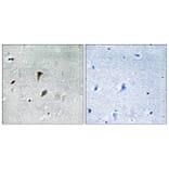 Immunohistochemistry - Anti-MAP2K3 (phospho Thr222) Antibody (A8139) - Antibodies.com