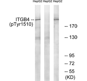 Western Blot - Anti-ITGB4 (phospho Tyr1510) Antibody (A1078) - Antibodies.com