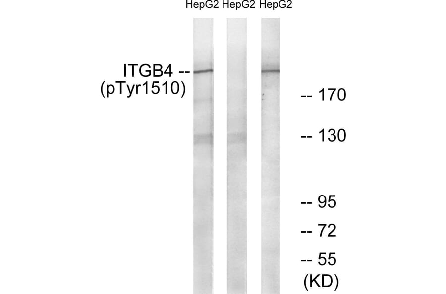 Western Blot - Anti-ITGB4 (phospho Tyr1510) Antibody (A1078) - Antibodies.com