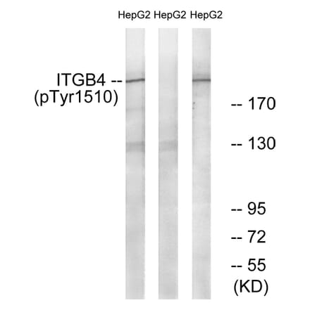 Western Blot - Anti-ITGB4 (phospho Tyr1510) Antibody (A1078) - Antibodies.com