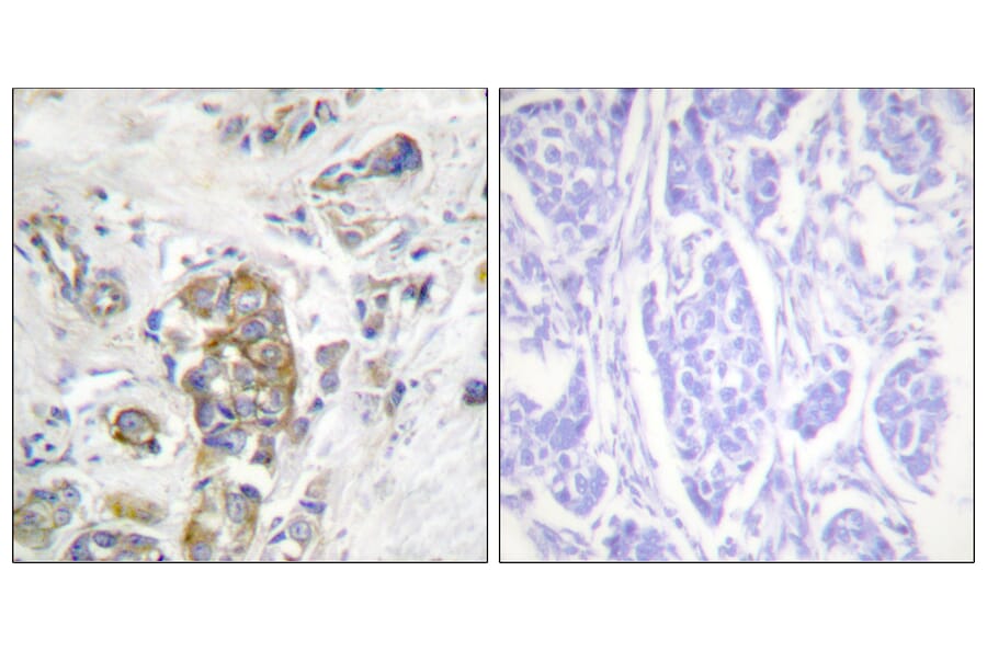 Immunohistochemistry - Anti-ITGB4 (phospho Tyr1510) Antibody (A1078) - Antibodies.com