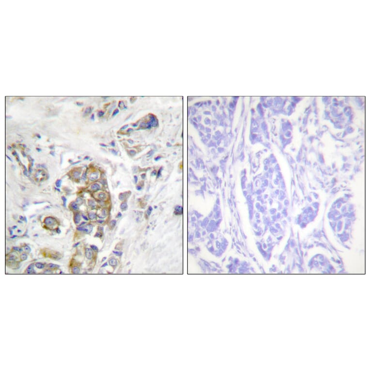 Immunohistochemistry - Anti-ITGB4 (phospho Tyr1510) Antibody (A1078) - Antibodies.com