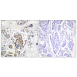 Immunohistochemistry - Anti-ITGB4 (phospho Tyr1510) Antibody (A1078) - Antibodies.com