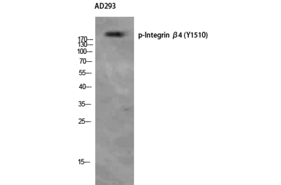 Western Blot - Anti-ITGB4 (phospho Tyr1510) Antibody (A1078) - Antibodies.com
