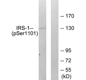 Western Blot - Anti-IRS-1 (phospho Ser1101) Antibody (A0446) - Antibodies.com