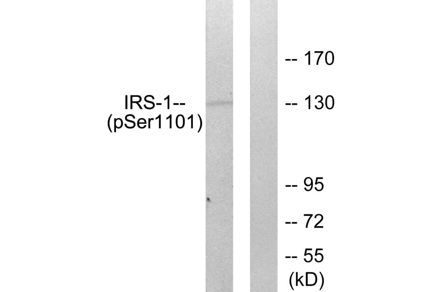 Western Blot - Anti-IRS-1 (phospho Ser1101) Antibody (A0446) - Antibodies.com